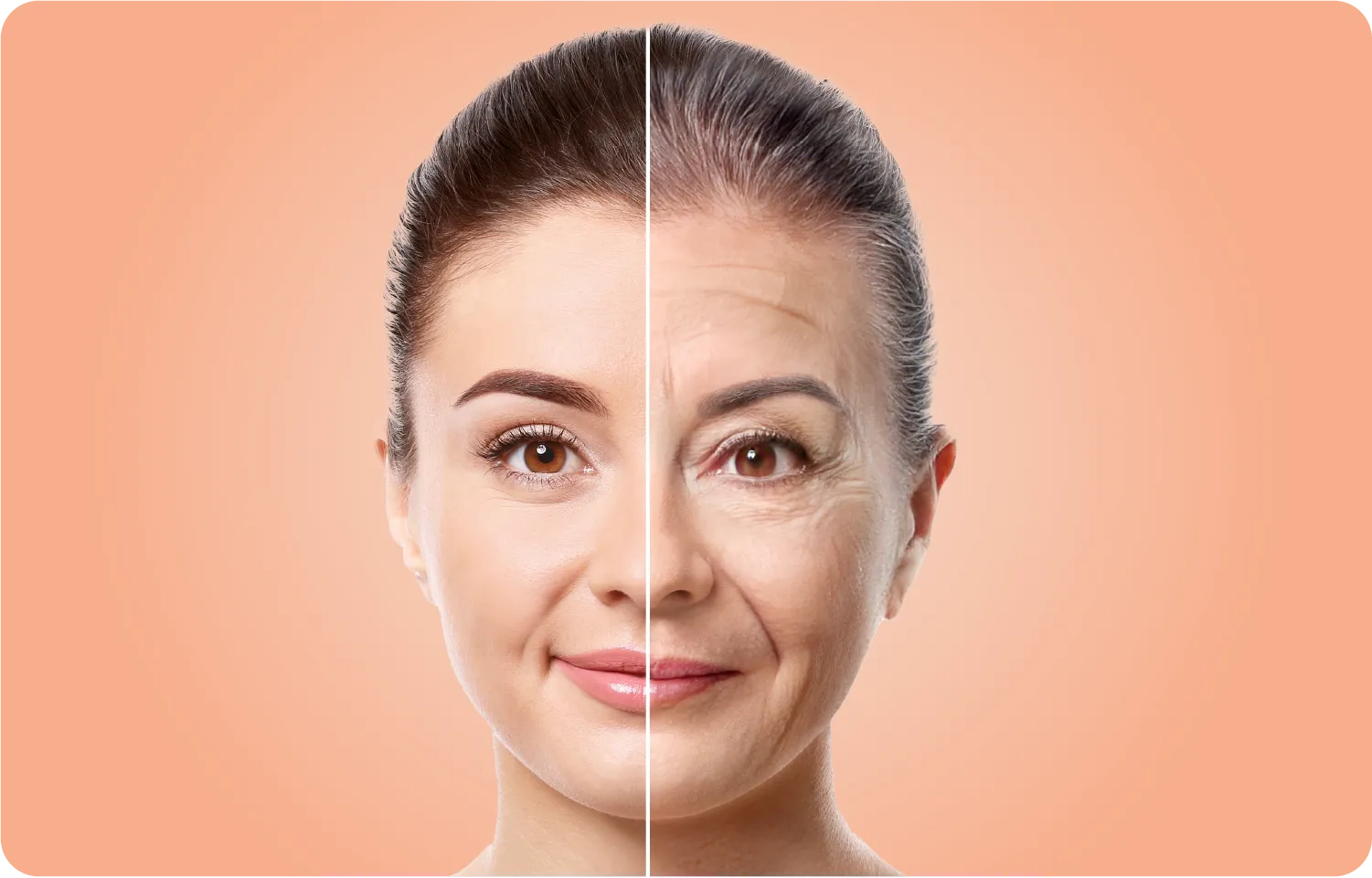 Facial Rejuvenation